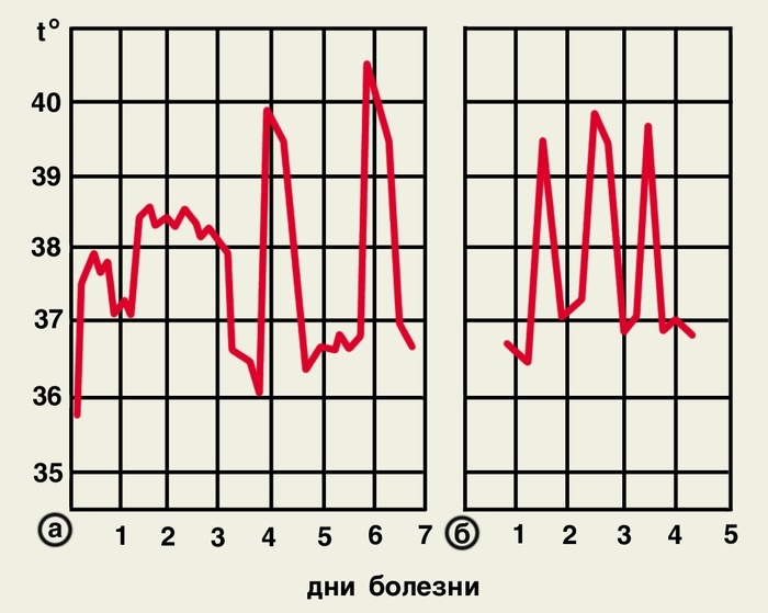 Рис. 3. Температурные кривые при трехдневной малярии: а — с 1-го до 3-го дня болезни продрома, с 4-го — приступы через 1 день; б — ежедневные приступы