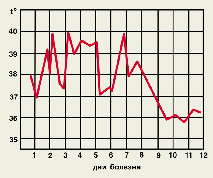Рис. 5а). Температурная кривая при тропической малярии у неиммунных лиц (неправильная лихорадка)