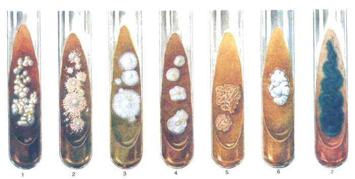 Рис. 2. Культуры патогенных грибов на питательных средах.