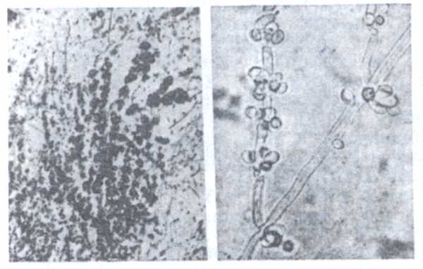 Рис. 3. Гроздья бластоспор Candida albicans в мицелии на кукурузном агаре.