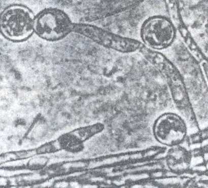 Рис. 4. Хламидоспоры Candida albicans на кукурузном агаре.