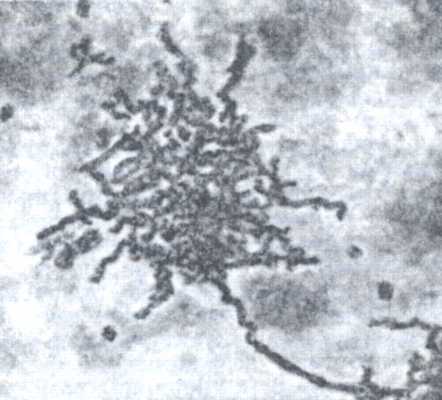 Рис. 1. 48-часовая культура Nocardia asteroides.