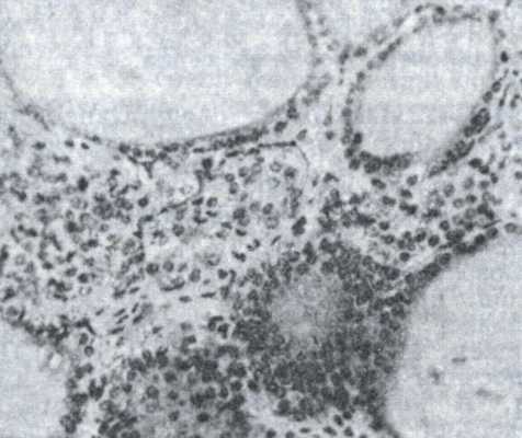 Рис. 1. Гистологическая картина щитовидной железы коровы.