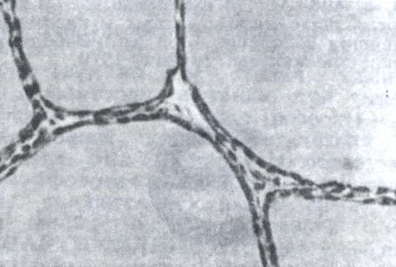 Рис. 3. Фолликулярный эпителий щитовидной железы при ослаблении её активности.